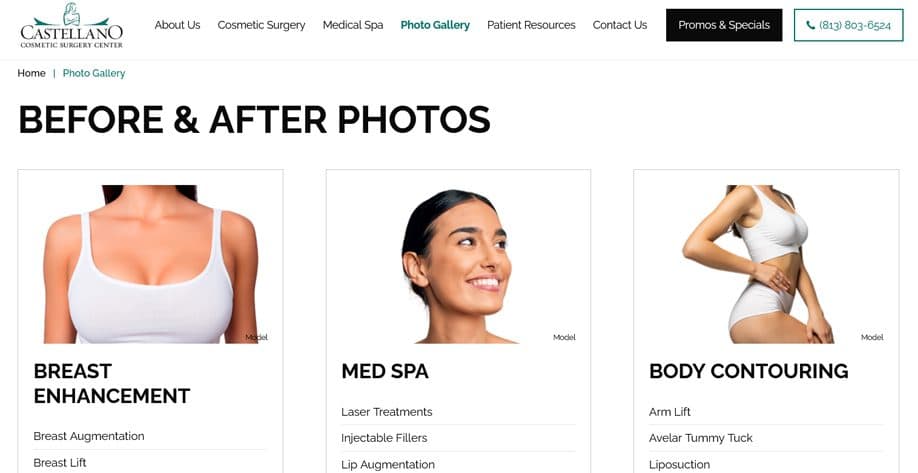 Live before-and-after gallery at Castellano Cosmetic Surgery