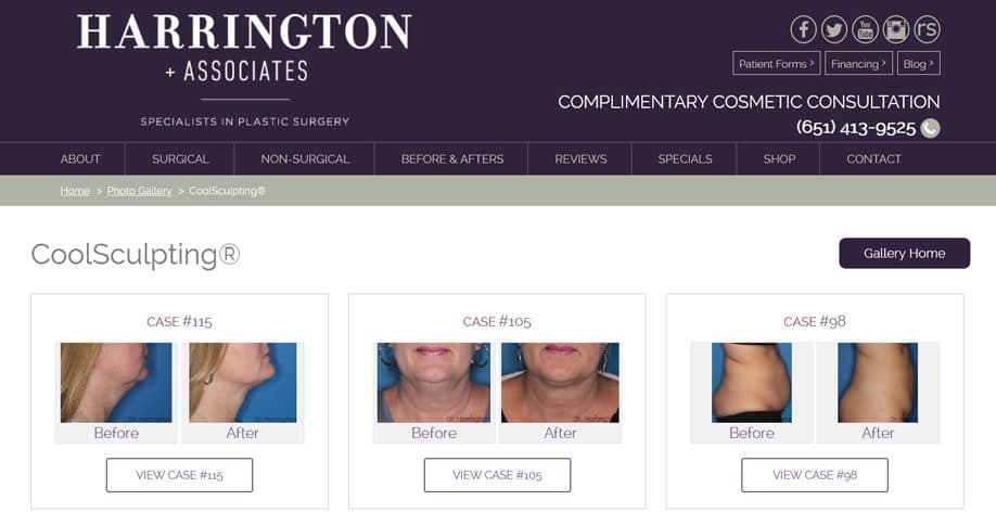 Live before-and-after gallery at Harrington Plastic Surgery