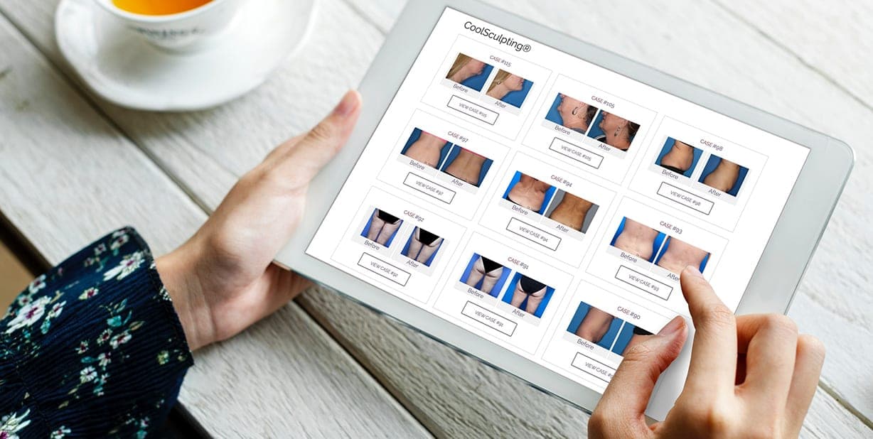 The Perfect Photo before-and-after gallery system in use on a tablet